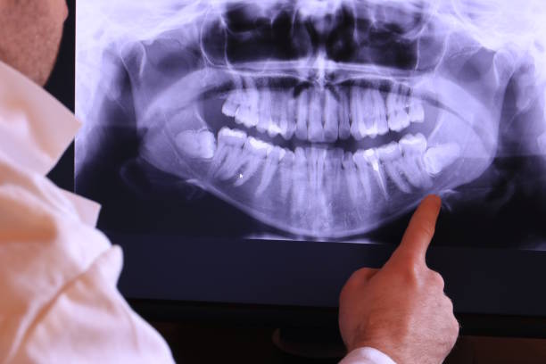 Best Walk-In Emergency Dentist in North Tustin, CA