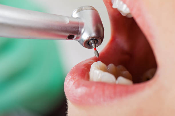 Best Emergency Treatment for Toothache in North Tustin, CA